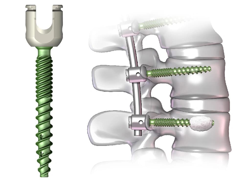 Spine